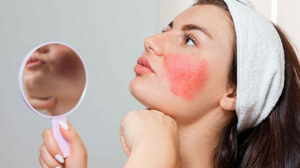Cómo prevenir y tratar las reacciones alérgicas en la piel