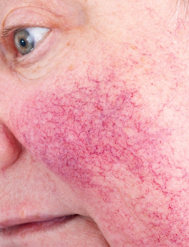 10 enfermedades de la piel más comunes y cómo tratarlas