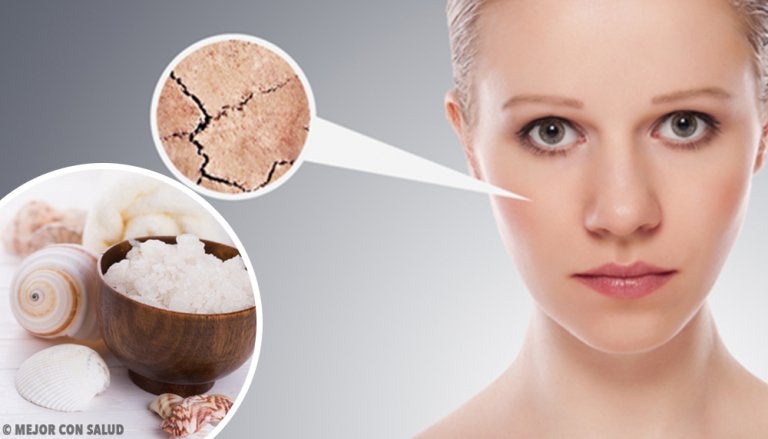 Cómo tratar la piel escamosa: consejos y remedios naturales