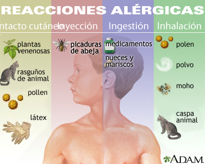 Cómo prevenir y tratar una reacción alérgica en la piel
